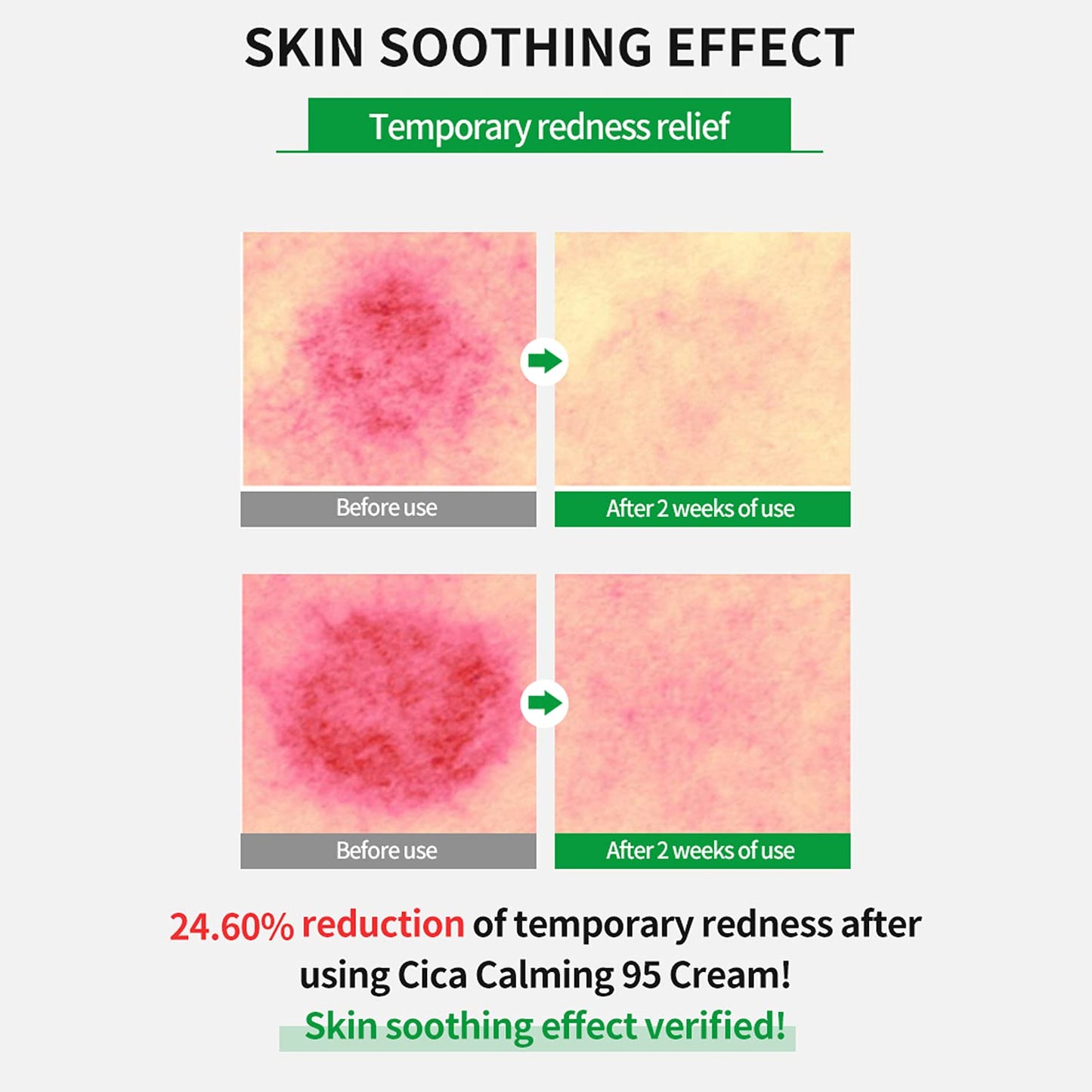 WELLAGE Real Cica Calming Trouble Ampoule 1.69 fl.oz + Cica Calming Cream 2.7oz Bundle