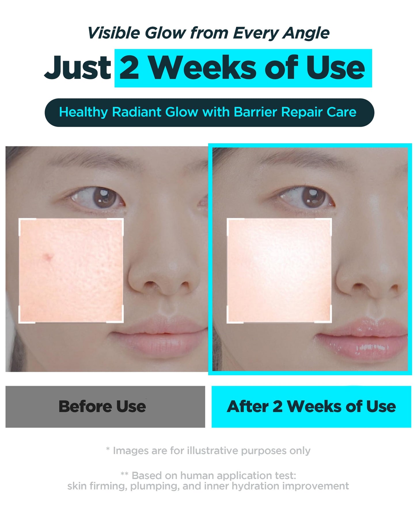 WELLAGE Korean Hyper PDRN Repair Anti-Aging Serum Ampoule - Hyaluronic Acid, Collagen Elasticity Pore Care with Sodium DNA, Beta-Glucan and Panthenol, 1.01 fl.oz